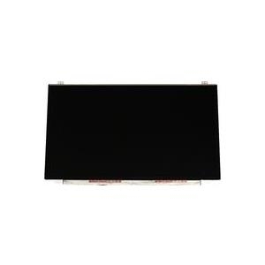 Lenovo 00hn836 - Anzeige - 39,6 Cm (15.6" ) - Lenovo (00hn836)