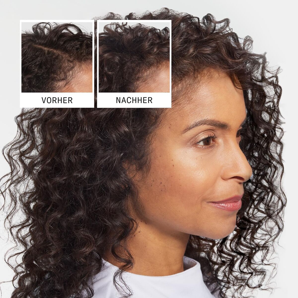 Shampoo Anticaduta Nioxin AntI-Hairloss 240 ml - Image 4