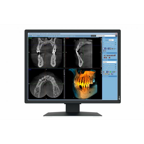 EIZO RadiForce MX217-SB Monitor PC 53,3 cm [21] 1200 x 1600 Pixel UXGA LCD Nero (2MP EIZO RADIFORCE MX217-SB)